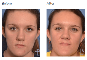 Plastic-Surgery-ENT-and-allergy -3